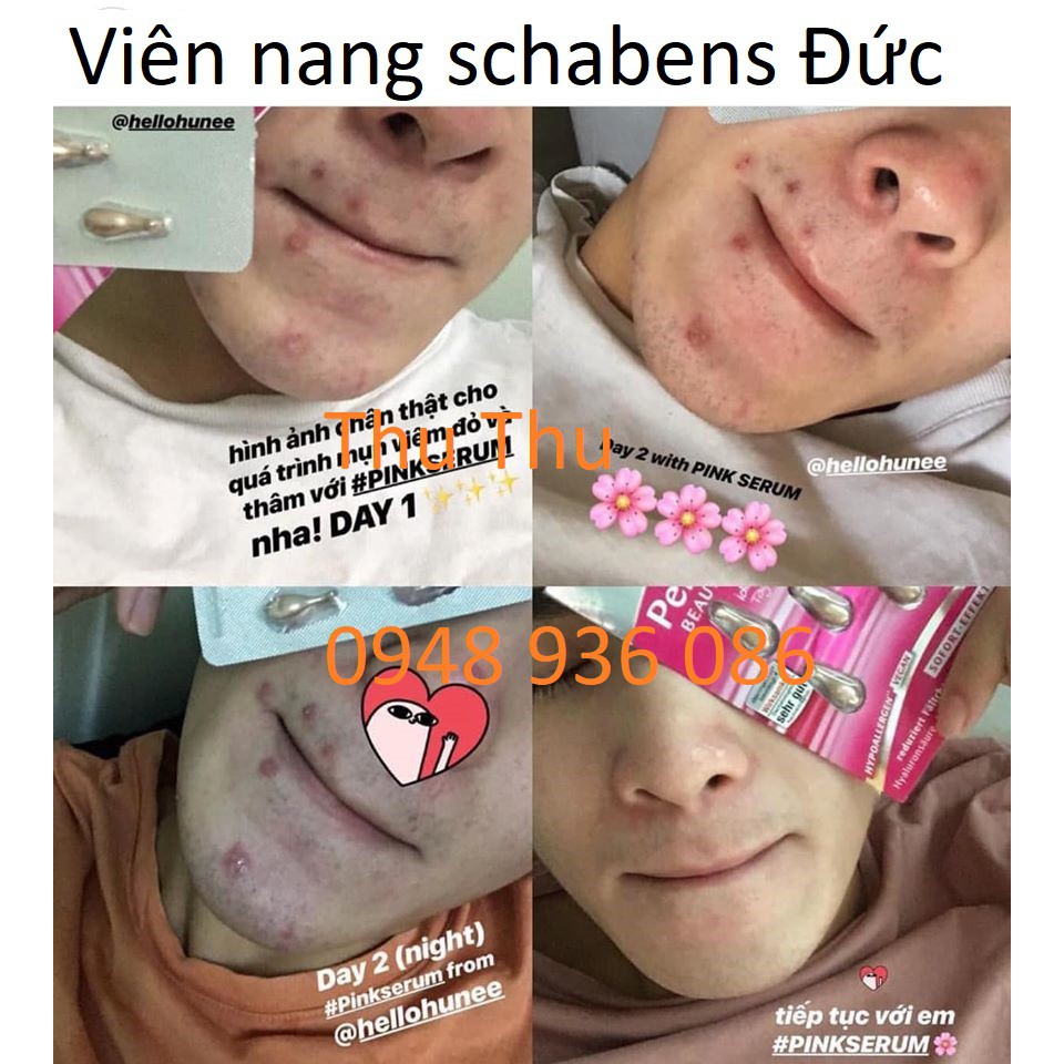 (review) VIÊN NANG SERUM SCHAEBENS Đức dưỡng da chuyên sâu