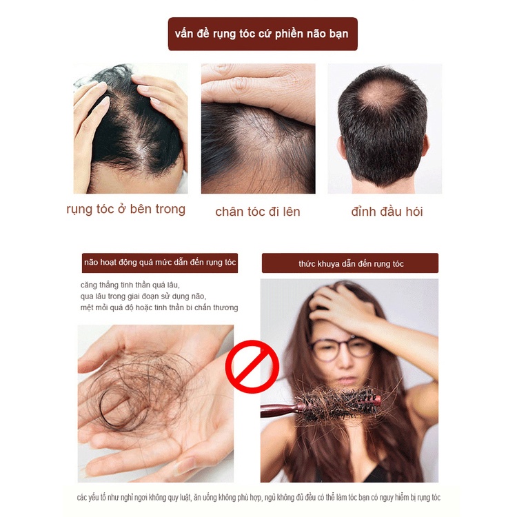 Tinh dầu mọc tóc nhanh,dau dưỡng tóc,serum mọc tóc,ngăn ngừa rụng tóc hair oil grow 30ml kích mọc tóc | BigBuy360 - bigbuy360.vn