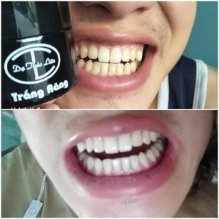 Trắng răng Dạ Thảo Liên than hoạt tính
