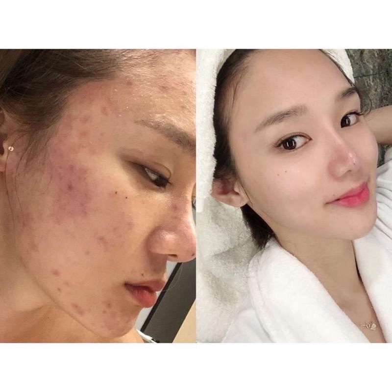 [Chính hãng]Kem phục hồi da Dmarino Cream Volayon