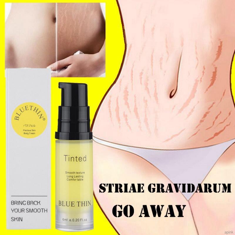 [Hàng mới về] Kem hỗ trợ giảm rạn da sau sinh làm sáng da hiệu quả 6ml | BigBuy360 - bigbuy360.vn