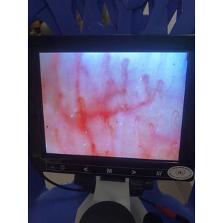 kính soi máu chất lượng SK-8