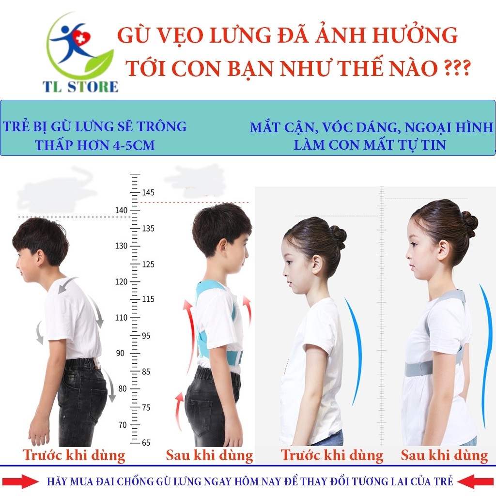 Đai chống xóa gù vẹo lưng dành cho trẻ em - thay đổi ngoại hình là thay đổi tương lai con bạn