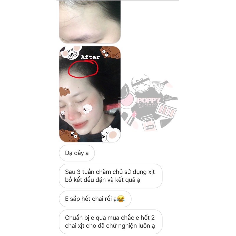 Xịt Tinh Chất Bồ Kết Kích Mọc Tóc Giảm Rụng Tóc Giảm Hói Giảm Bò Liếm - Poppy Corner | BigBuy360 - bigbuy360.vn