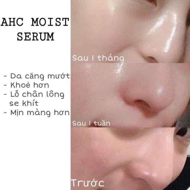 TINH CHẤT DƯỠNG DA AHC CAPTURE SERUM