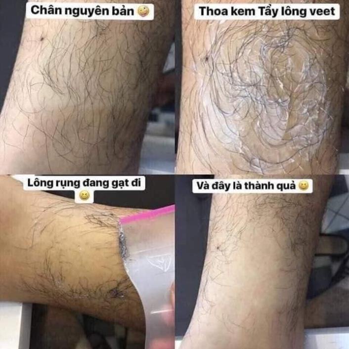 (giá sỉ = lẻ) KEM TẨY LÔNG VEET PHÁP 100ml