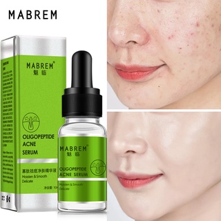 Serum MABREM Oligopeptide Hỗ Trợ Giảm Mụn Dưỡng Ẩm Làm Trắng Da Chống Nếp Nhăn Giúp Thu Nhỏ Lỗ Chân Lông Và Sáng Da sáng da kiềm dầu chống lão hóa da giúp da siêu căng bóng 10ml