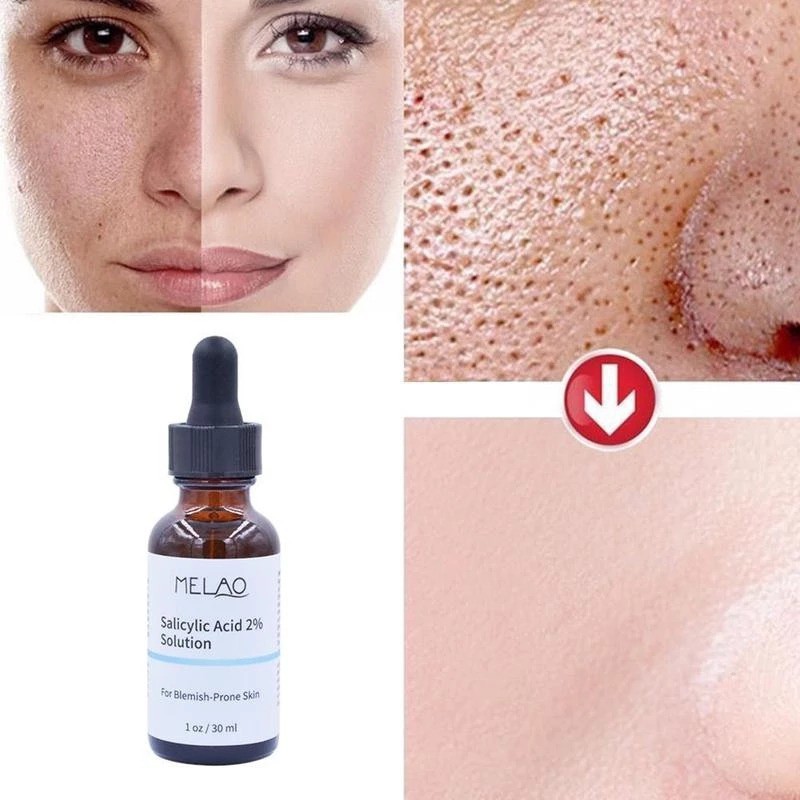 Tinh chất Melao Salicylic Acid 2% dưỡng ẩm se khít lỗ chân lông tẩy tế bào chết chăm sóc da hiệu quả 30ml