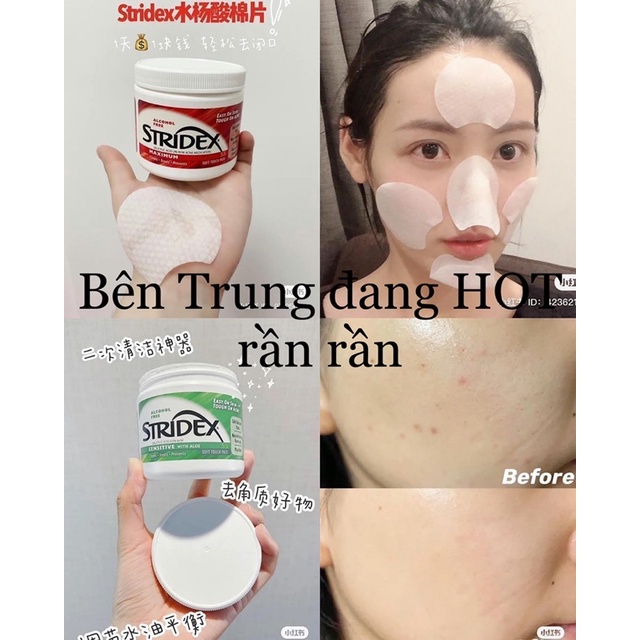 Bông lau trụ mụn STRIDEX 90m