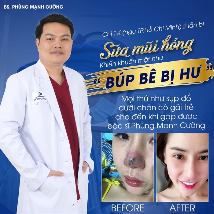 Dịch vụ chỉnh mũi hỏng tại Gangwhoo