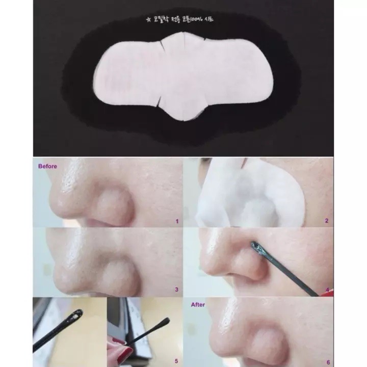 Lẻ miếng dán đẩy mụn đầu đen Goodbye Blackhead Ciracle