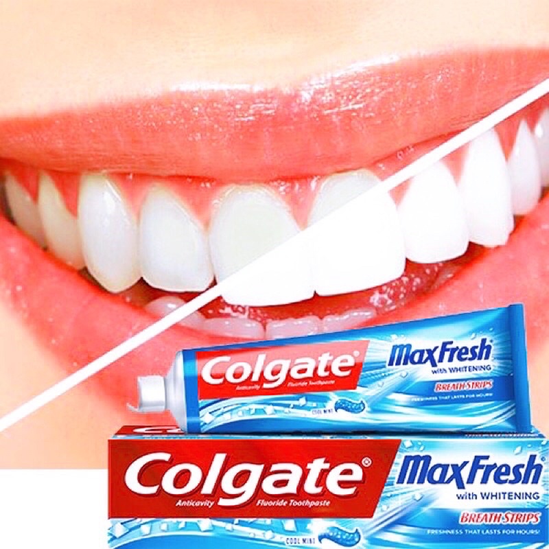 Kem đánh trắng răng Colgate Maxfresh Air Mỹ