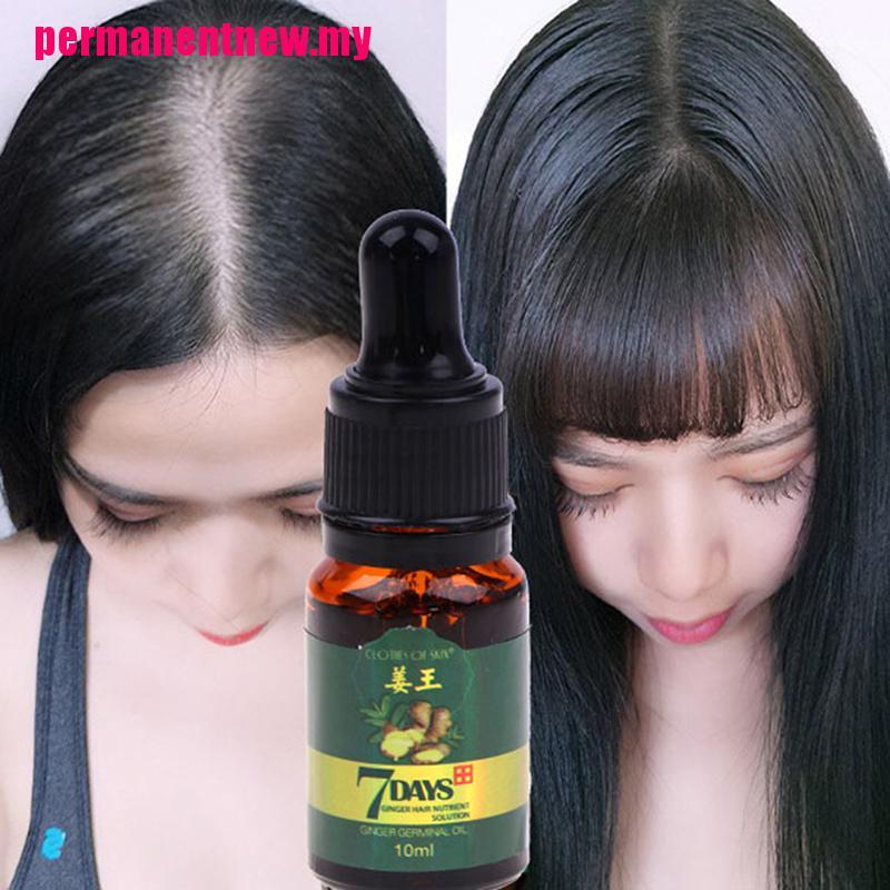 (hàng Mới Về) Tinh Dầu Gừng Chăm Sóc Tóc Chống Rụng Tóc 7 Ngày 10ml