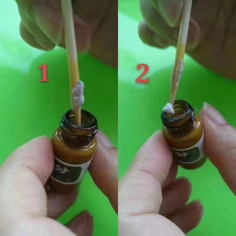 Kem tẩy nốt ruồi chấm nám tàn  nhang