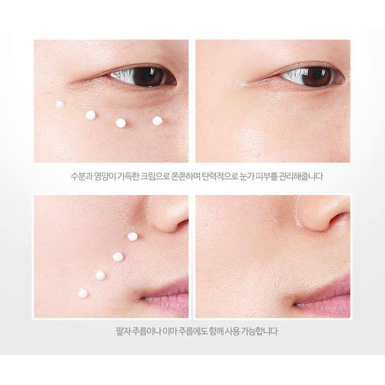 Kem mắt Medi Flower Collagen Wrinkle Eye Cream 40ml Sale tới 92%  720k còn 115k