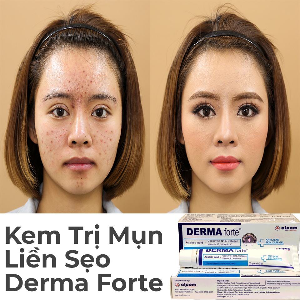 ✅[CHÍNH HÃNG] Gel Giảm Mụn, Ngừa Thâm Derma Forte 15G