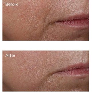 Sample 2ML - Tinh chất sáng da Perricone MD deep crease serum