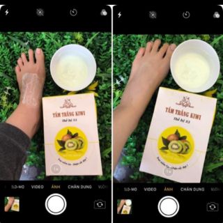 Tắm trắng kiwi