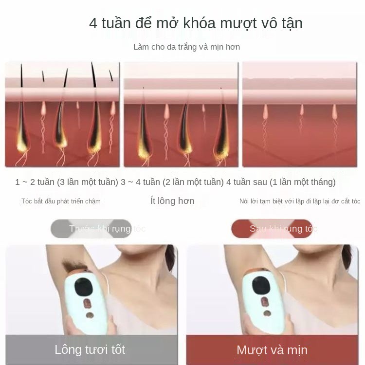 Laser Máy cạo lông vùng kín Freezing Point Epilator không đau tại nhà toàn thân môi nách dụng cụ