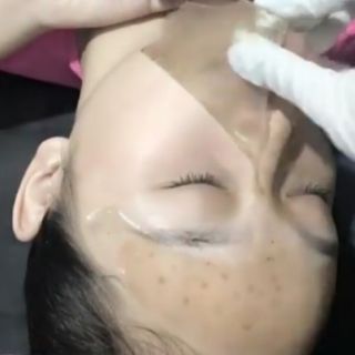 MẶT NẠ COLLAGEN TẾ BÀO GỐC TRẮNG DA