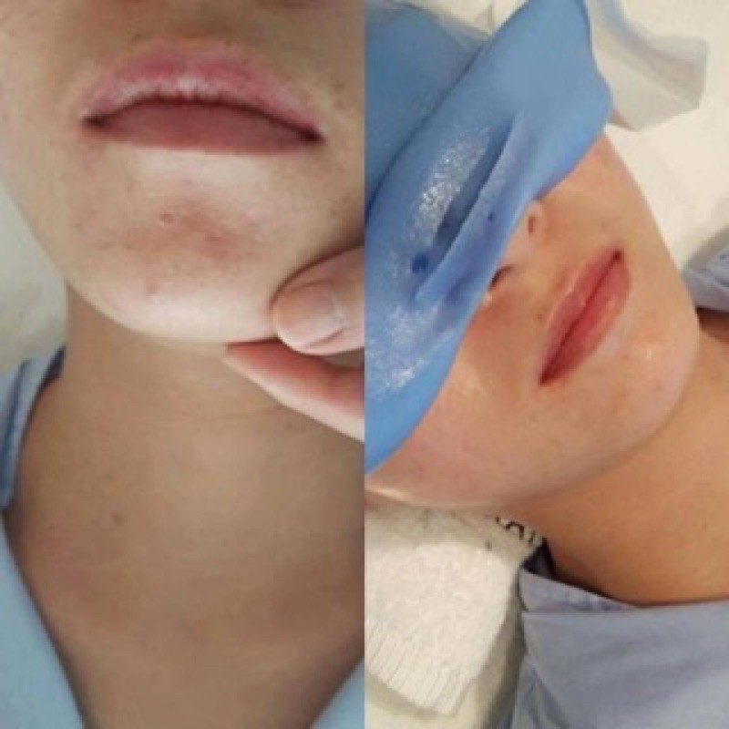 Mặt Nạ Dẻo CIVASAN hy+ Balsam Powder