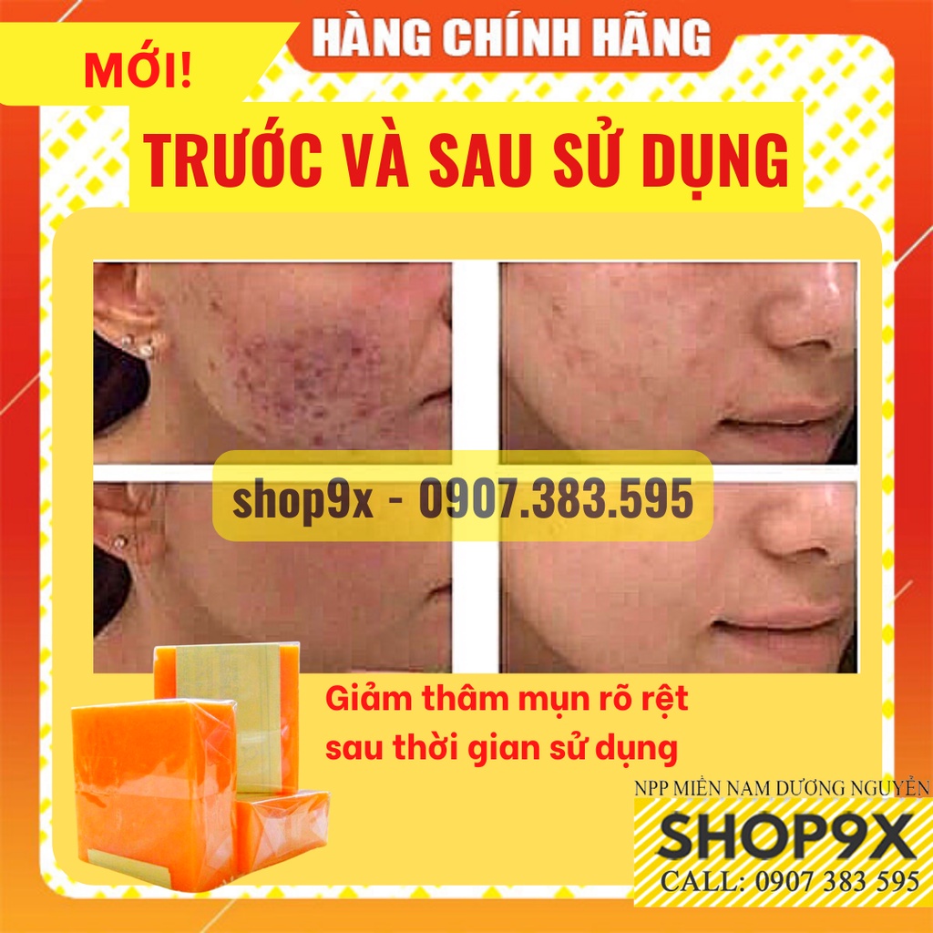 Xà Phòng Nghệ Và Cám Gạo Cao Cấp Sáng Da Ngừa Mụn Cho Mặt Và Body