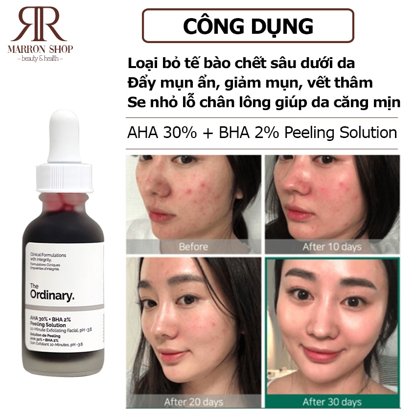 Tinh chất The Ordinary tẩy tế bào chết, cải thiện da AHA 30% BHA 2% Peeling Solution 30ml