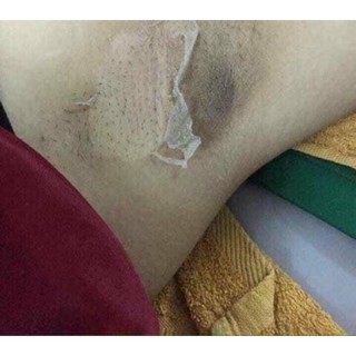 Peel ti,nách, bikini TCA USA | BigBuy360 - bigbuy360.vn