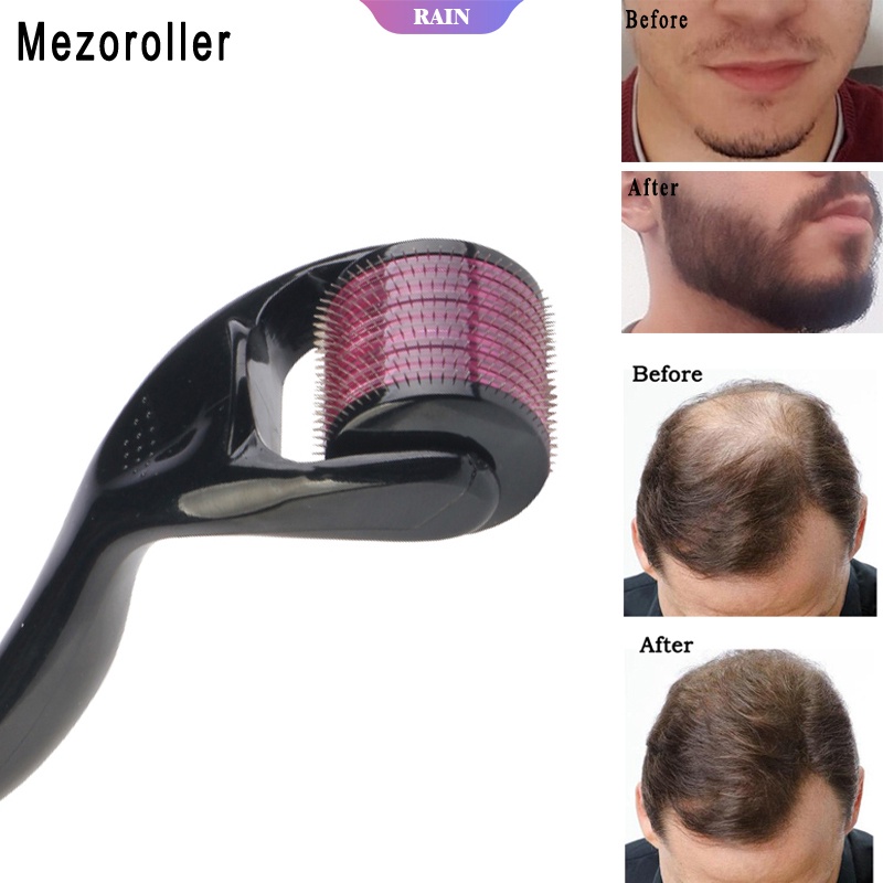 Cây Lăn Kim 540 Micro Chuyên Dụng Kích Thích Mọc Râu/Tóc 0.25/0.5mm