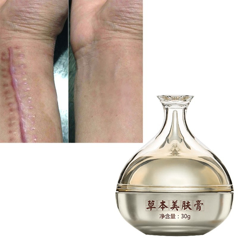 [Hàng mới về] Kem trị sẹo phục hồi làn da mặt an toàn và hiệu quả 30g