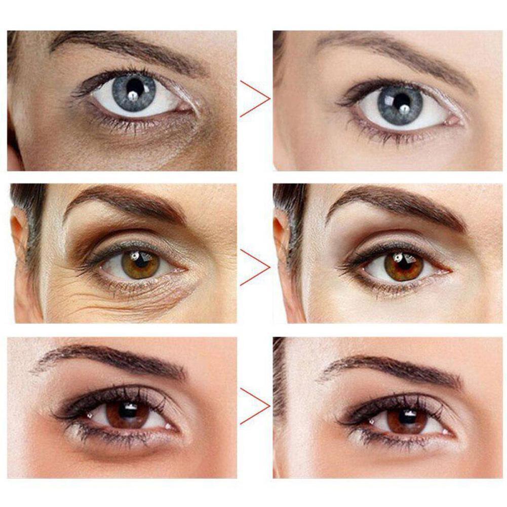 15G Snail Eye Cream Eye Essence Replenishing Moisturizing Nourish and Firming Eyes