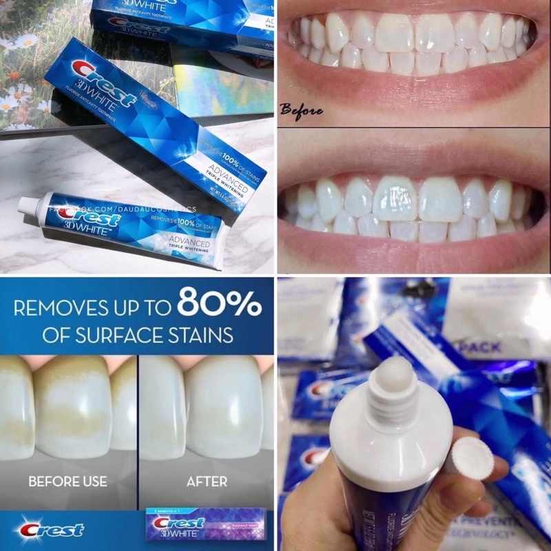 Tách lẻ Kem Đánh Răng Crest 3D White Advanced set 5tube siêu trắng răng