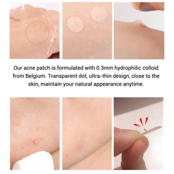 Miếng dán mụn LANBENA tràm trà giảm mụn ban ngày ban đêm Acne Pimple Patch