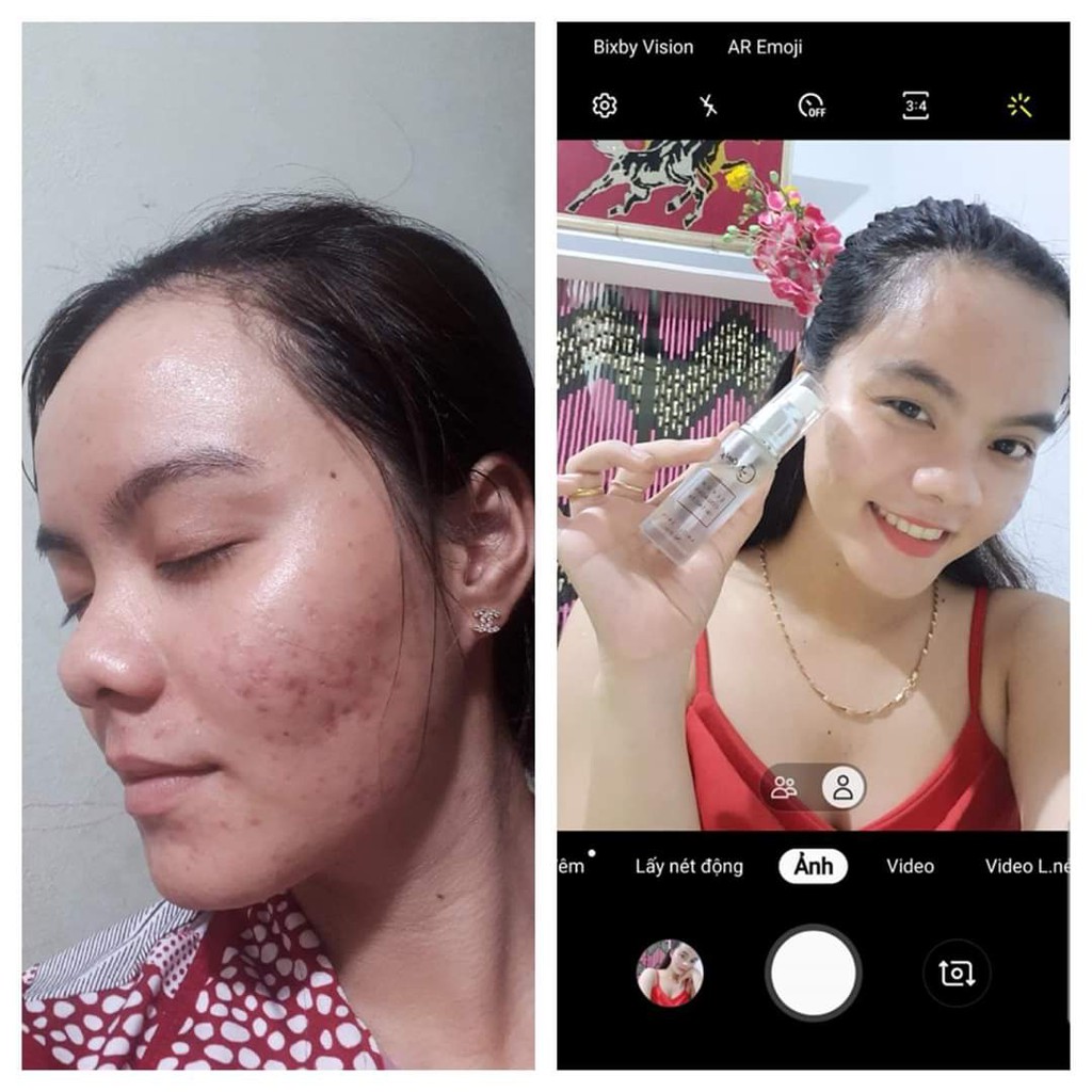 Serum Collagen Amoliskin | BigBuy360 - bigbuy360.vn