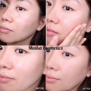 (Mã NSF020280 giảm 80K) Serum Cosrx AC Collection Blemish Spot Clearing 40ml