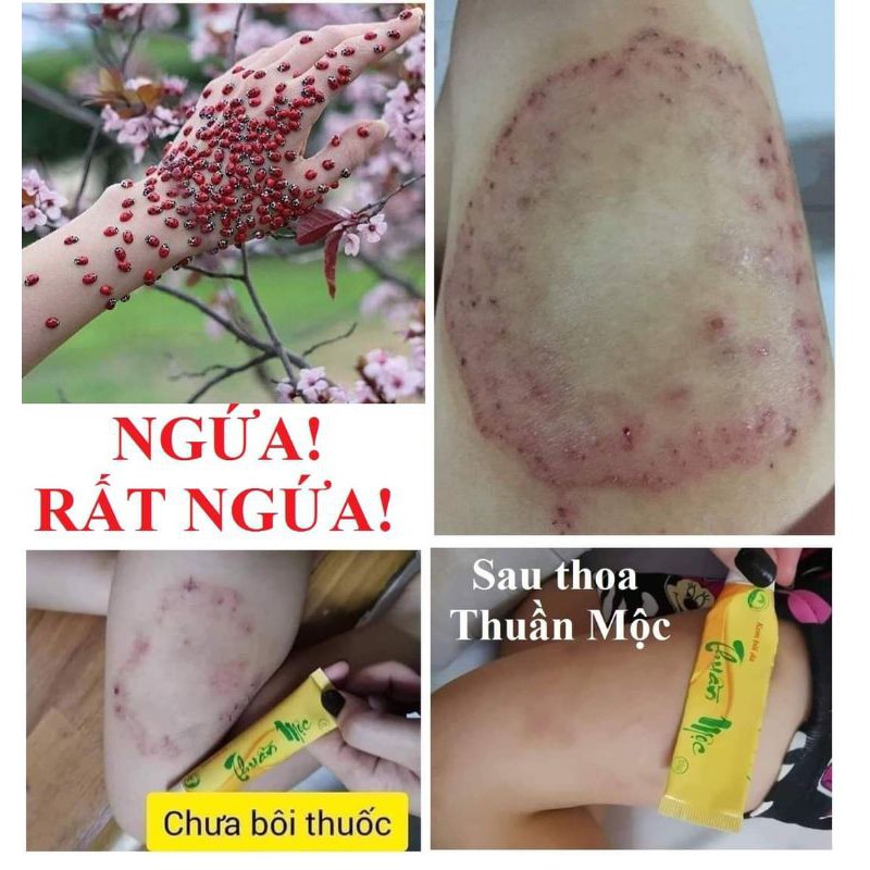 [Chính hãng]Kem bôi da Thuần_mộc