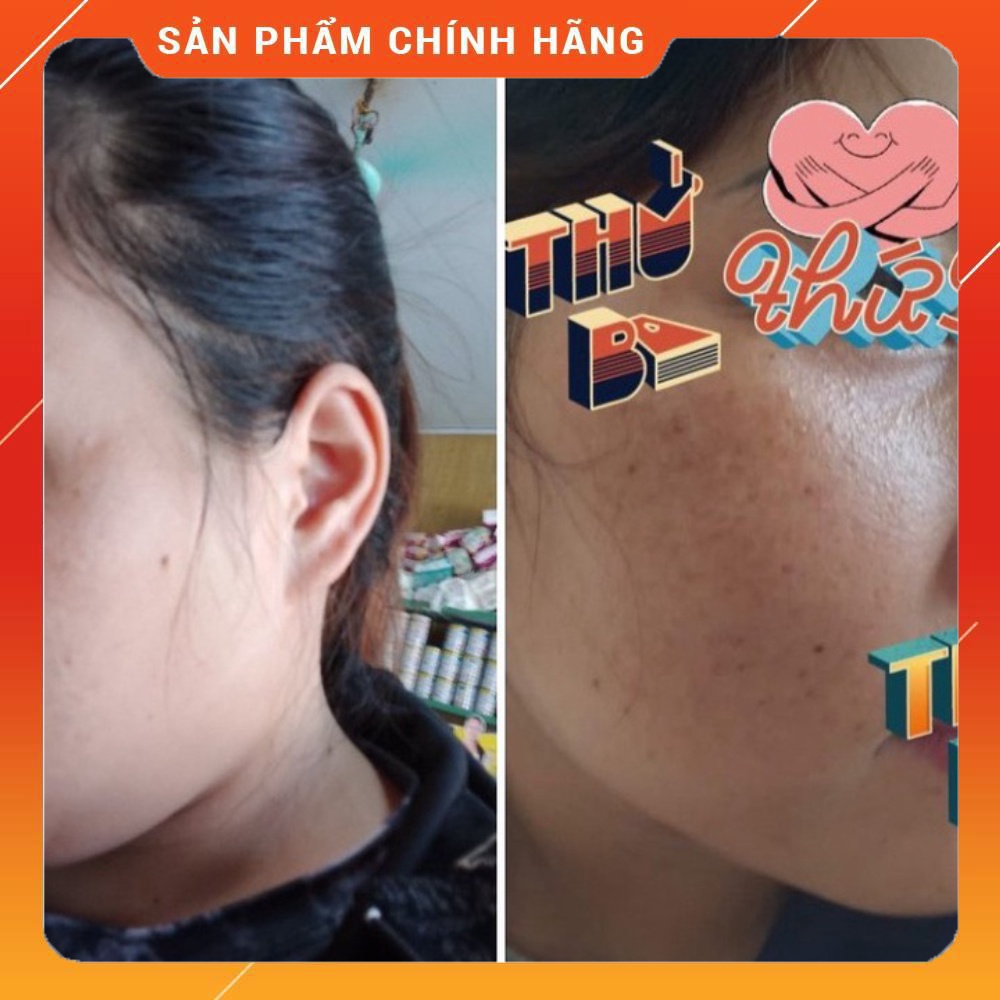 Viên uống Glutathione 2500mg DR.HANY 99 Beauty Hàn Quốc siêu hủy nám, trắng da, thải độc hộp 60 viên