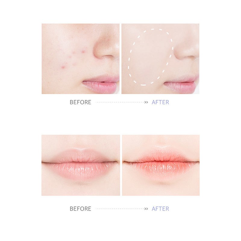 Bút che khuyết điểm che phủ mụn và đốm trên da mặt | BigBuy360 - bigbuy360.vn