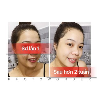 Bột trắng răng sóc con