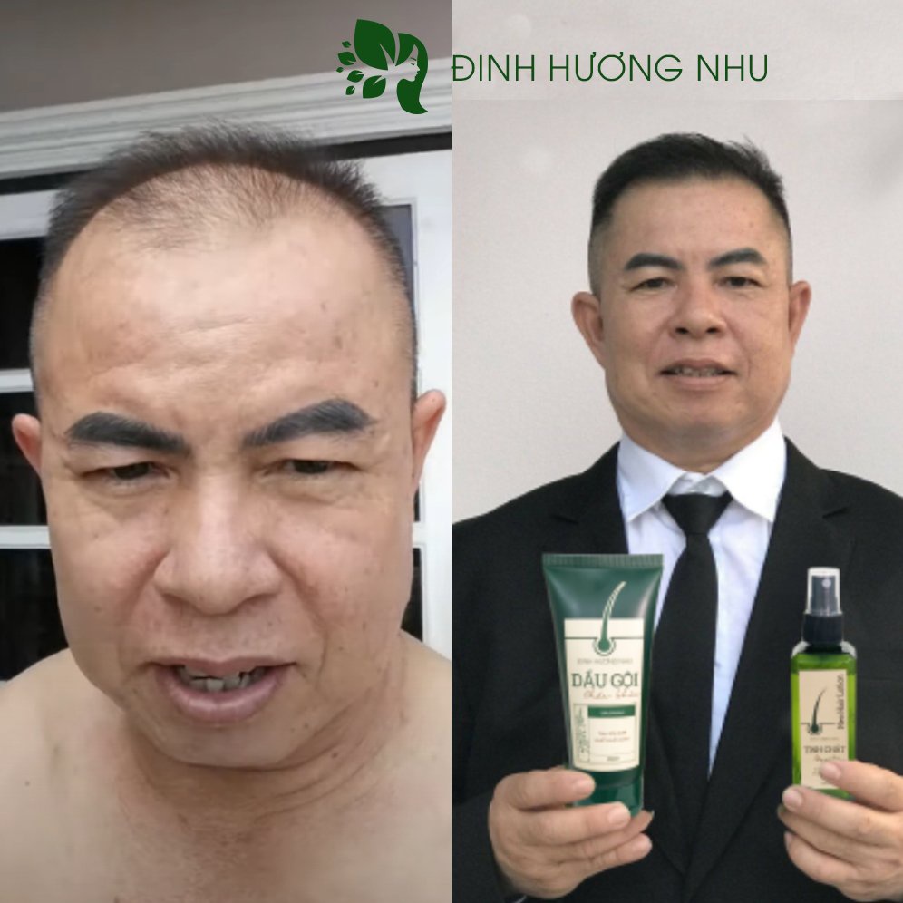 Dầu Gội Đinh Hương Nhu Chai 250ml