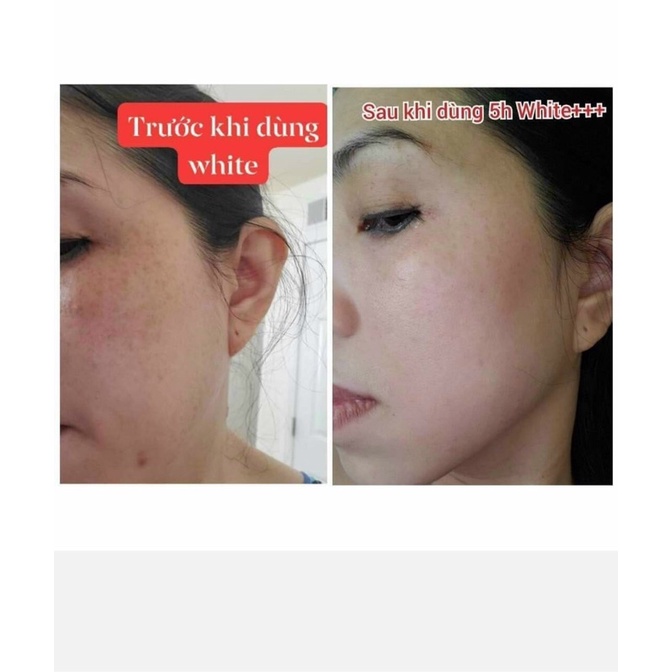 Viên uống Huna Royal White Trắng da Mờ Nám Cân bằng nội tiết