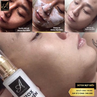 Detox thải độc bọt biển Acosmetics [CHÍNH HÃNG]