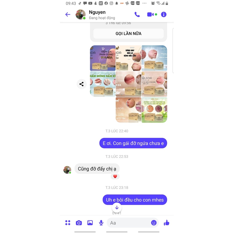 Kem bôi da Bolada phòng ngữa các bệnh ngoài da ngăn ngừa và loại bỏ các loại nấm trên da