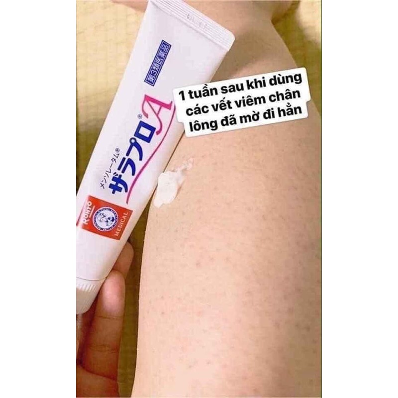 [FREE SHIP] Kem Giảm Viêm Nang Lông Rohto