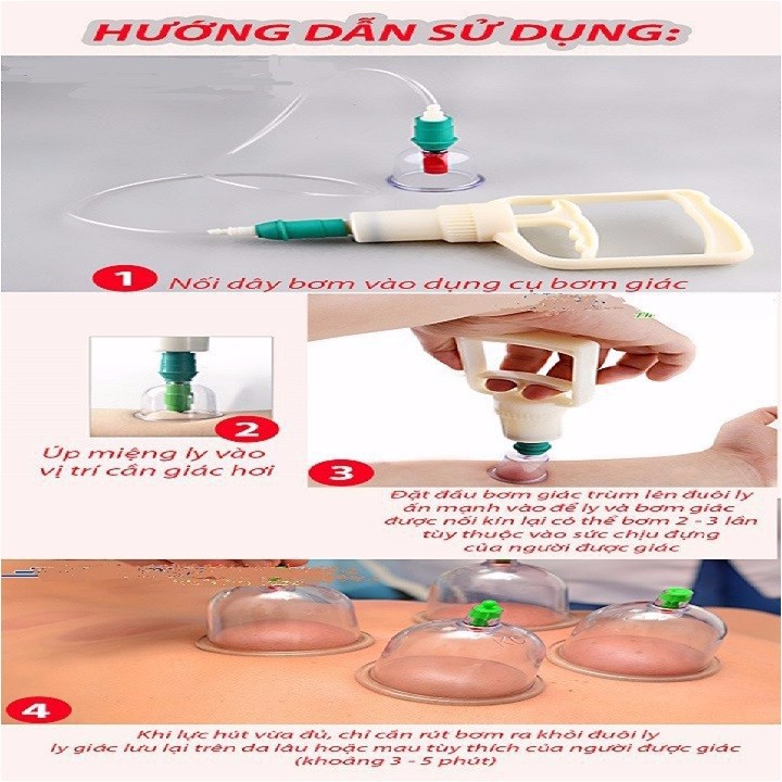 Hộp 12 ống giác hơi hút chân không - không cần lửa tiện lợi