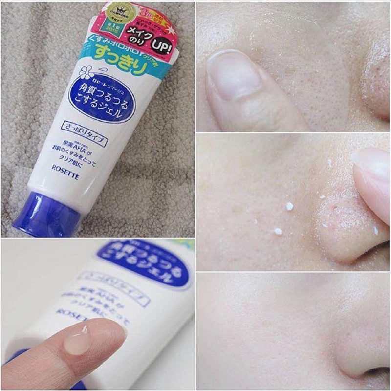 Tẩy tế bào chết Rosette Peeling Gel