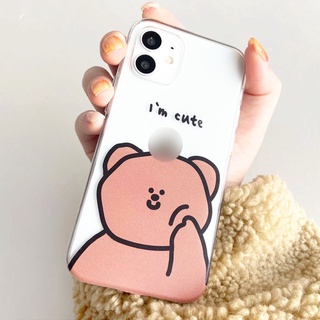 Ốp lưng xiaomi redmi 10C/note 10 /note 8/ note 8 pro/note 9s/note 9/note 7/ redmi 9A/redmi 9/8/8A  I'm cute _7