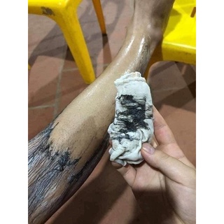 Triệt lông nano gel