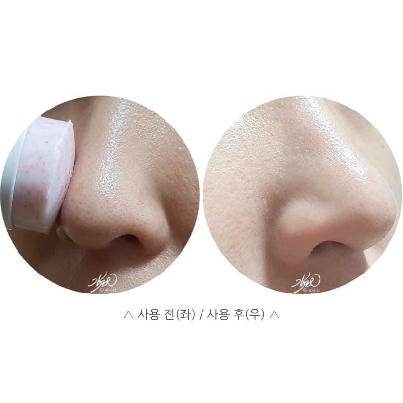 Thanh lăn mụn So’natural Red Peel Clear Stick | BigBuy360 - bigbuy360.vn