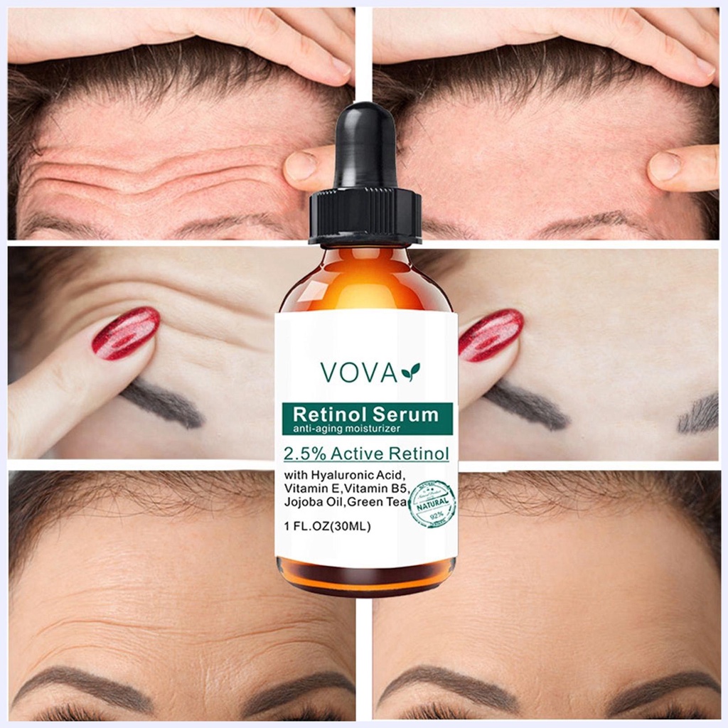 Serum Retinol 2.5 Retinol Chống Lão Hóa Se Khít Lỗ Chân Lông Làm Mờ Vết Thâm Làm Sáng Da